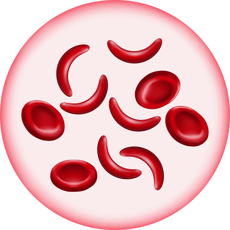 Sickle Cells